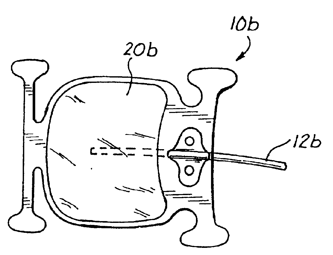 Sutureless implantable device and method for treatment of glaucoma