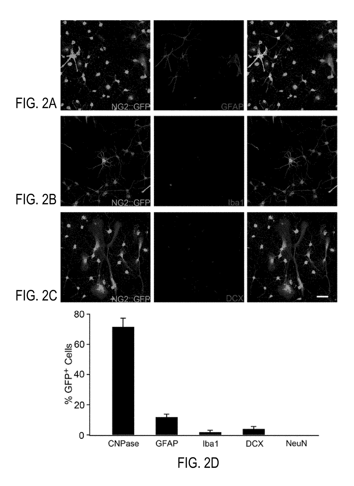 GENERATING GABAergic NEURONS IN BRAINS