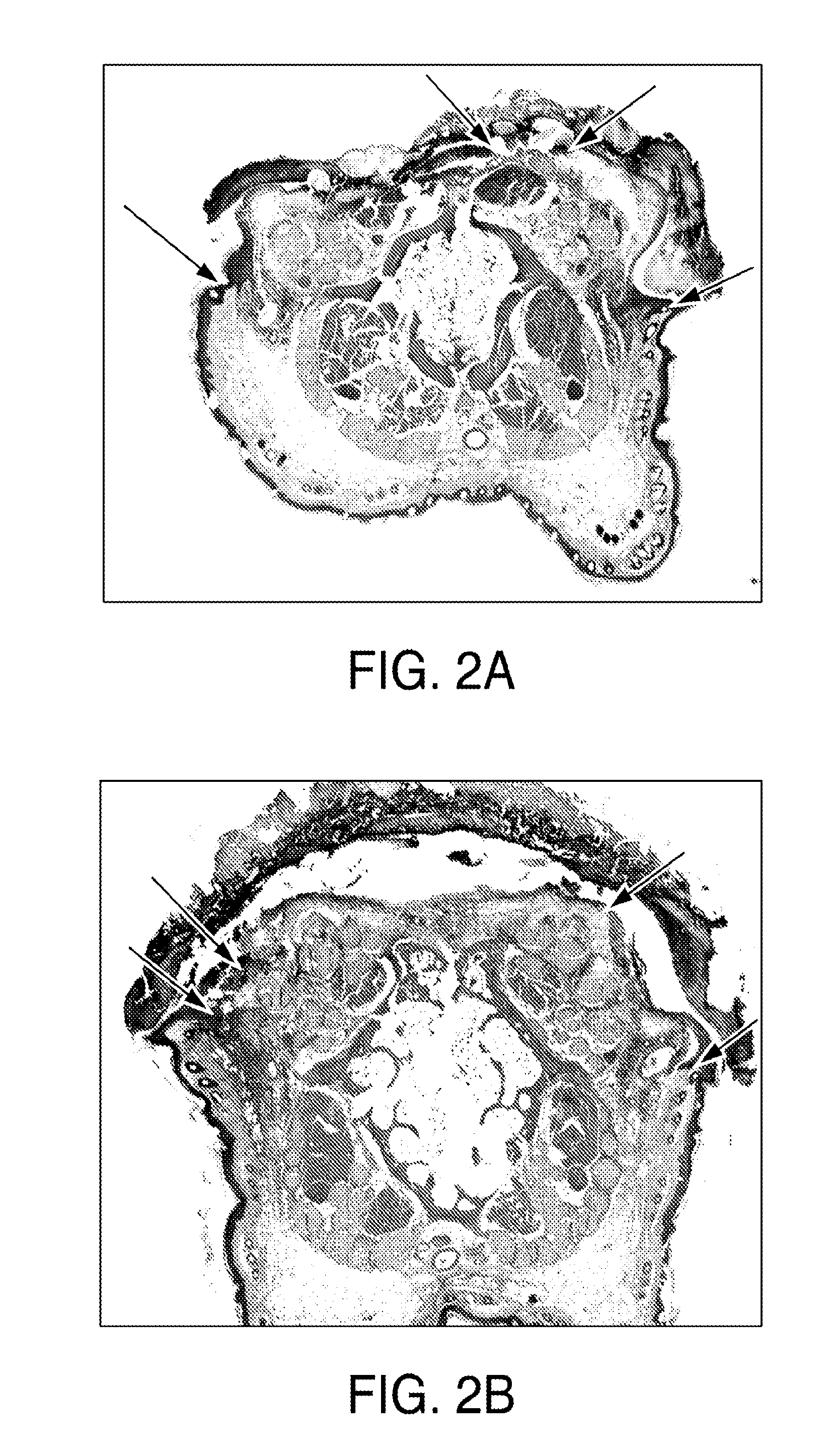 Stem cell compositions and methods for would healing