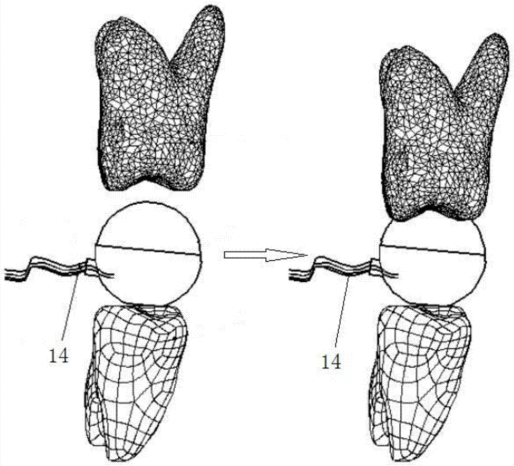 Multi-direction biting force measuring device based on force sensor