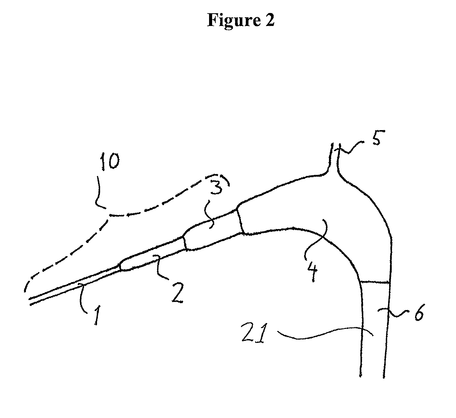 Bubble reducer for eliminating gas bubbles from a flow