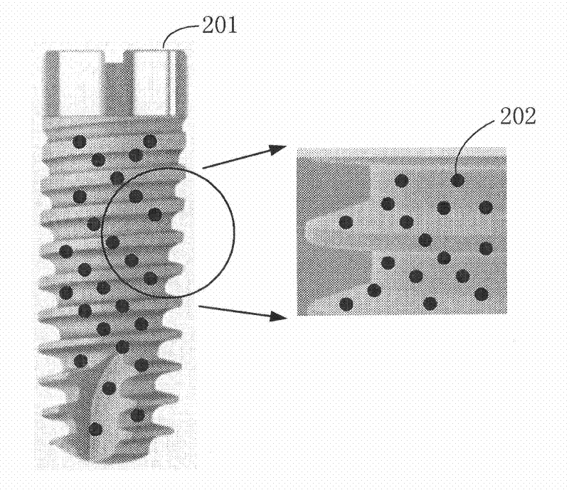 Surface treatment method of dental implant