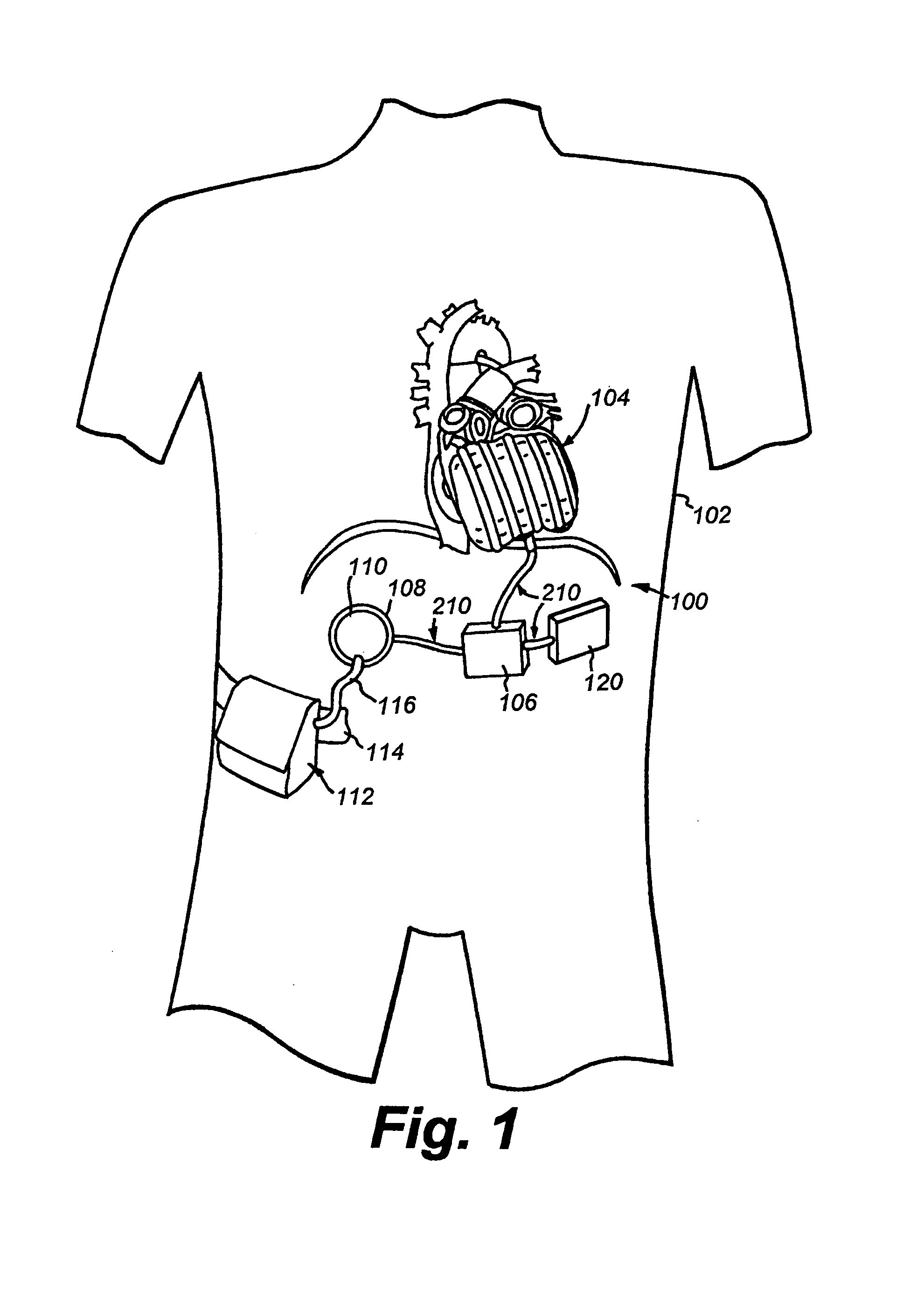 Apparatus and method for balanced charging of a multiple-cell battery pack