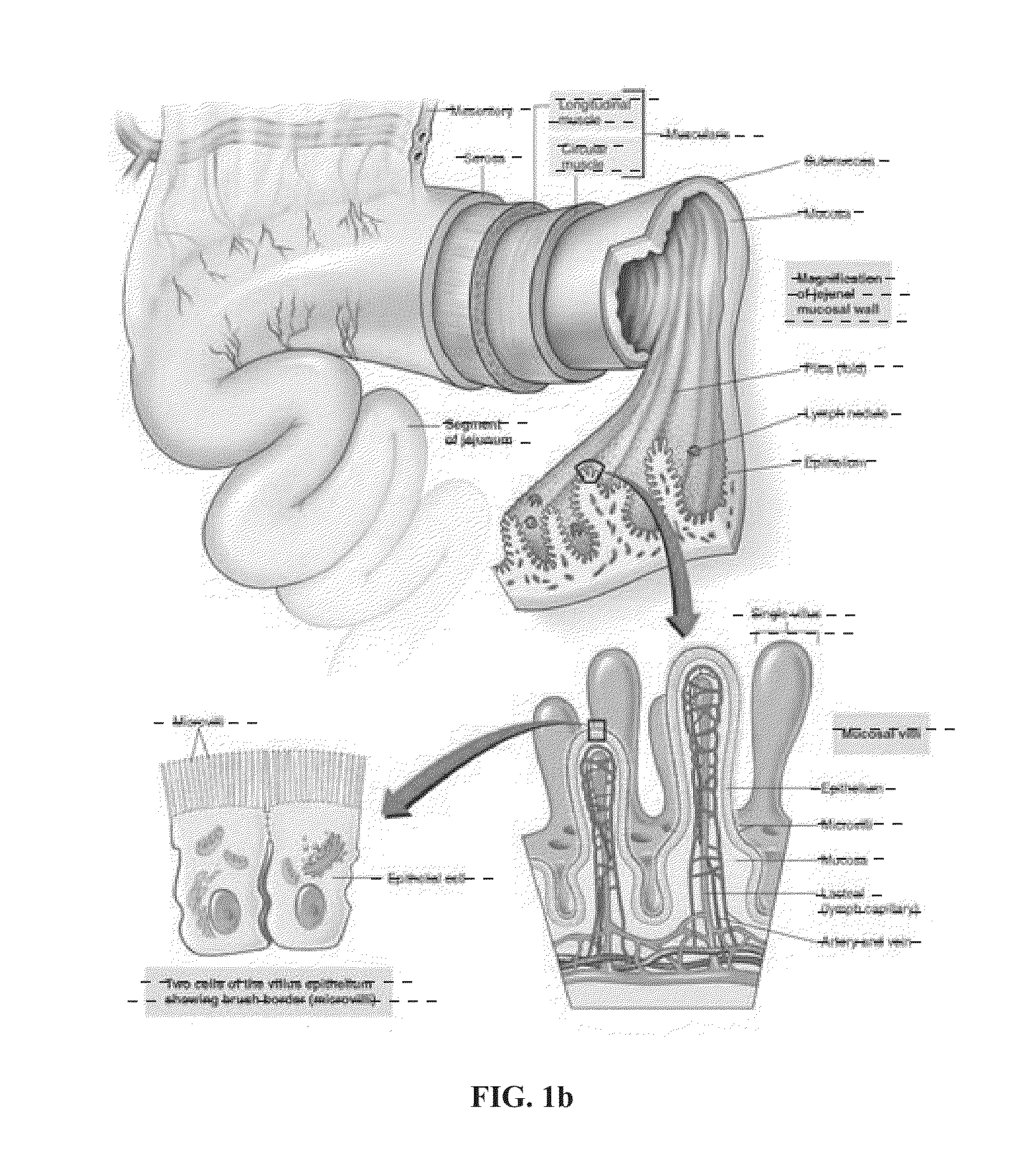 Fiber scaffolds for use in esophageal prostheses