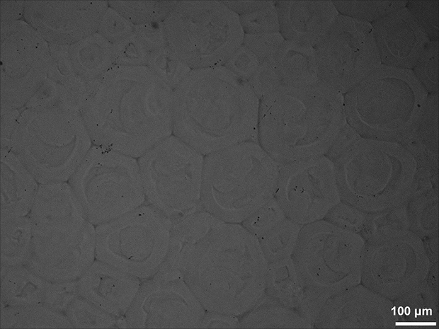 Injectable dextran hydrogel microsphere filler and preparation method thereof