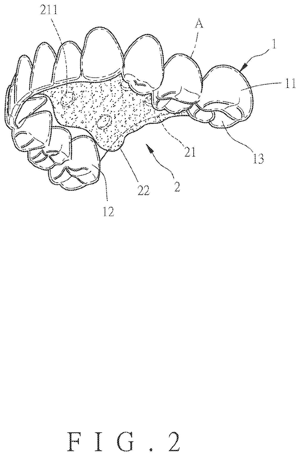 Oral appliance as swallowing auxiliary device with coverage of maxillary teeth and a manufacturing method thereof