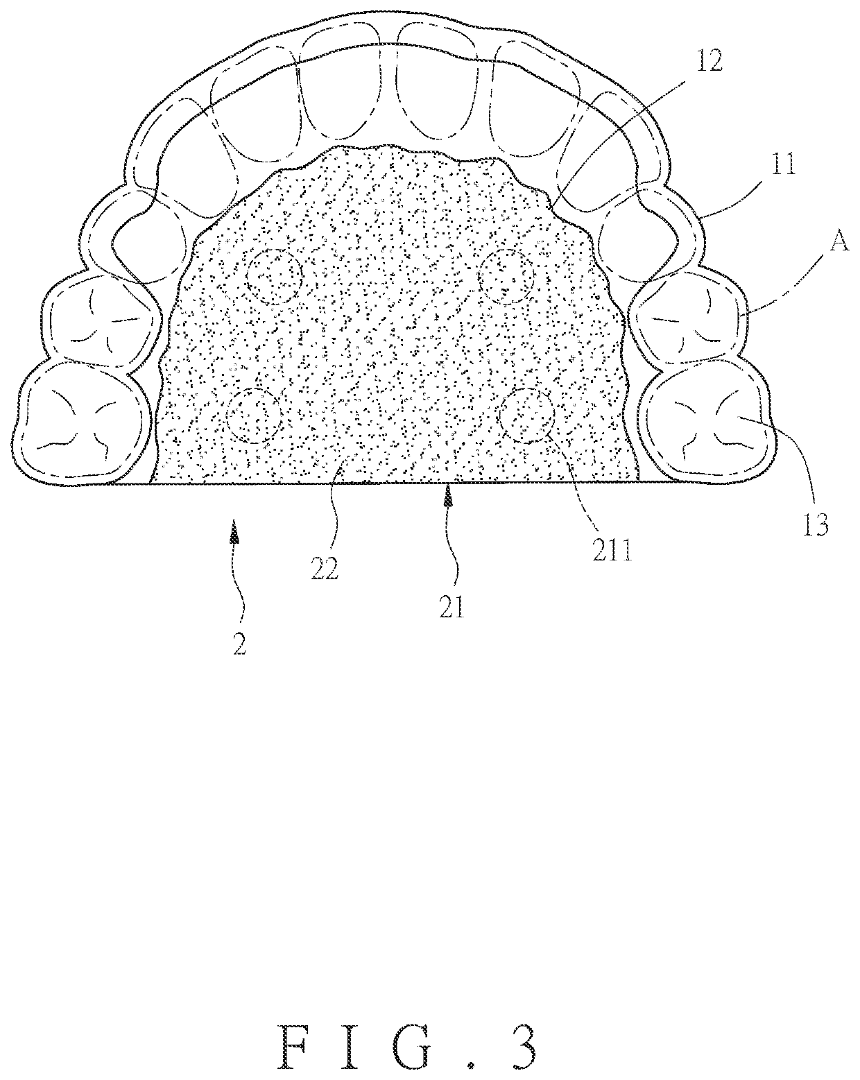 Oral appliance as swallowing auxiliary device with coverage of maxillary teeth and a manufacturing method thereof