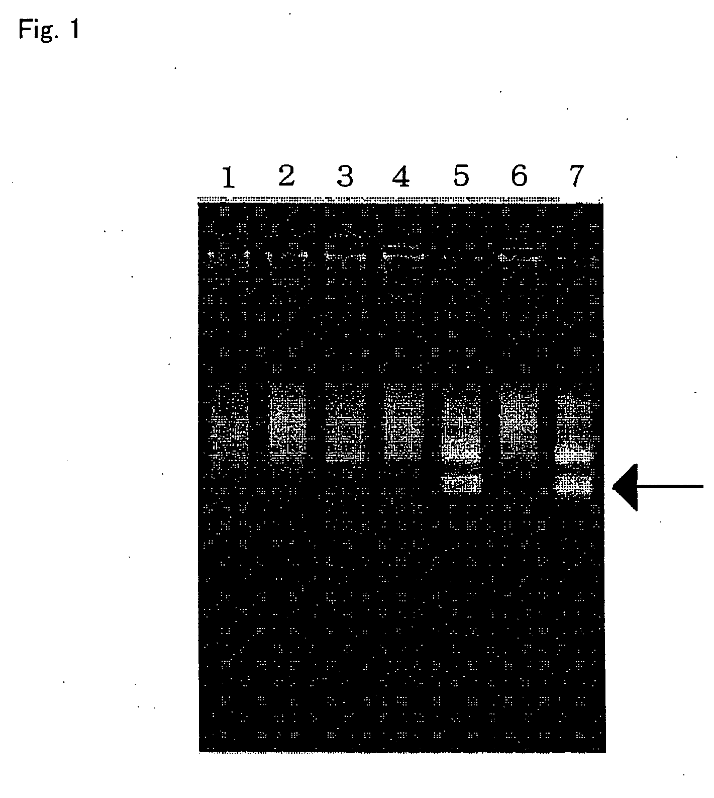 Method of typing gene polymorphisms