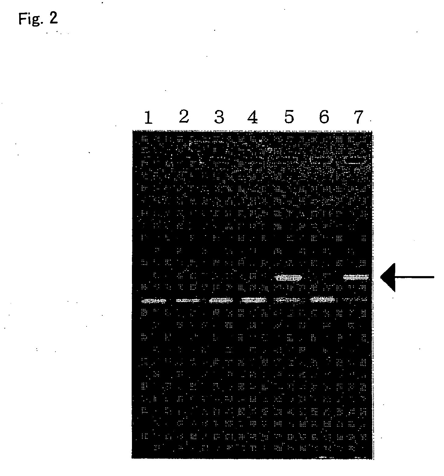 Method of typing gene polymorphisms