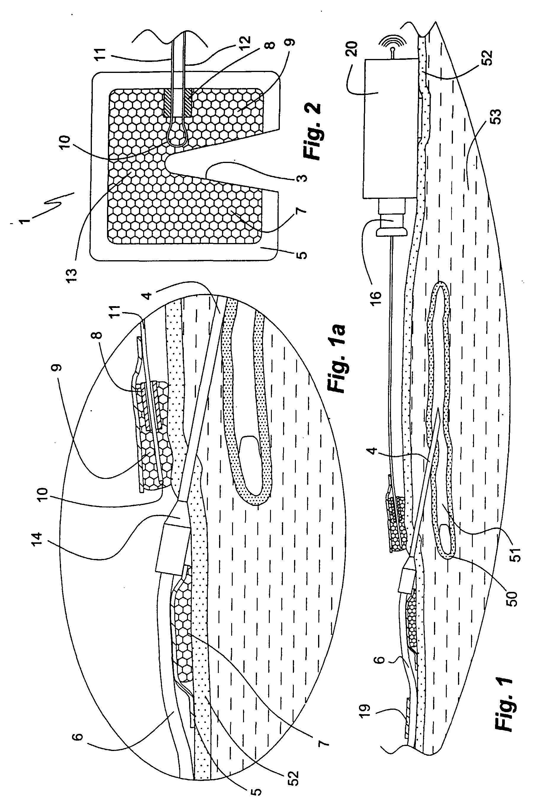 Means and Method for Detection of Blood Leakage from Wounds