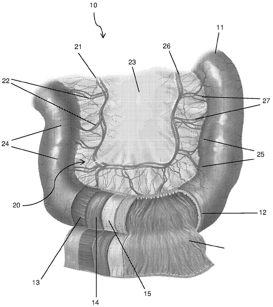 Implant and method for producing an implant