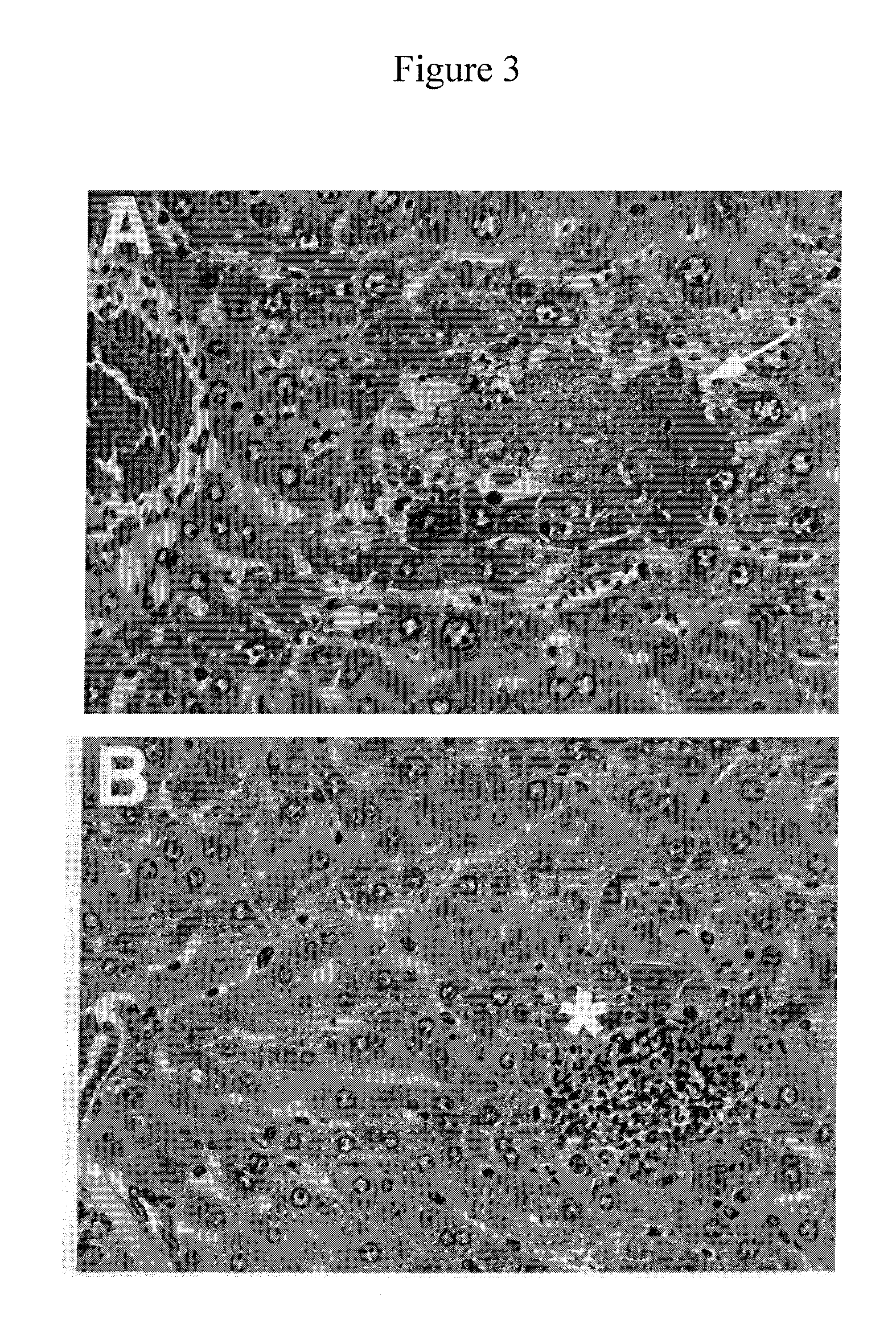 Inhibitors of bacterial plasminogen activators