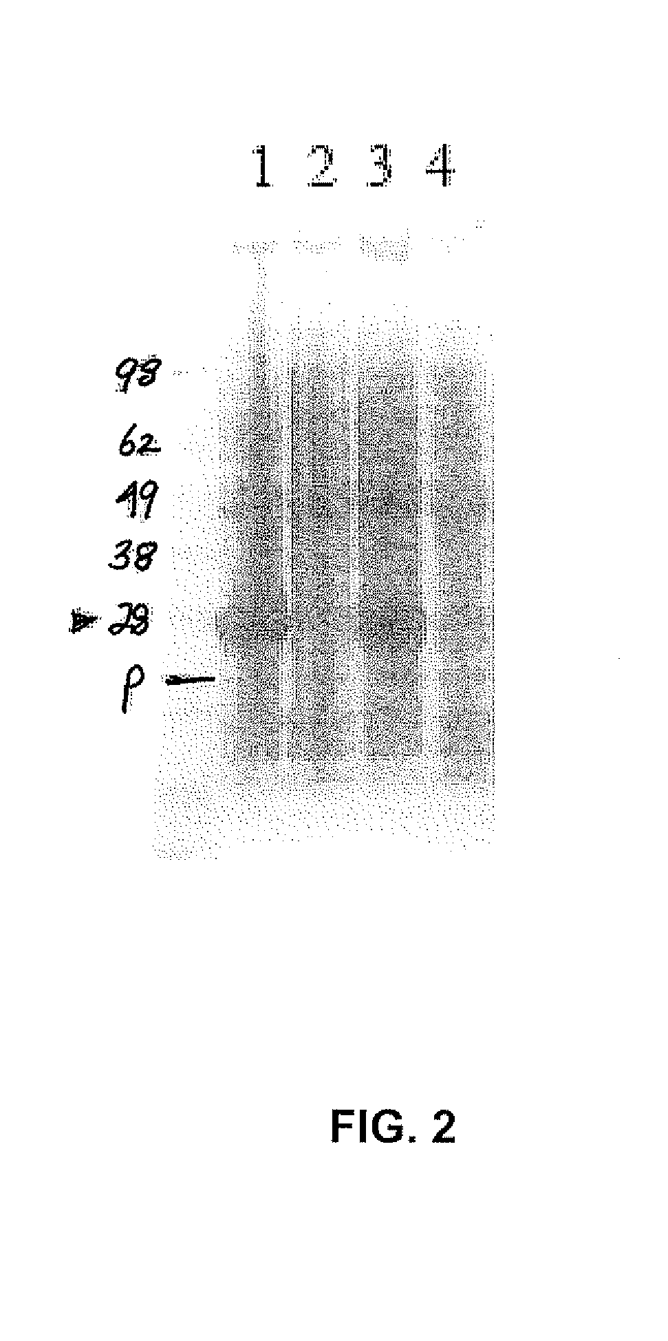 Chloramphenicol Acetyl Transferase (CAT)-Defective Somatostatin Fusion Protein And Uses Thereof