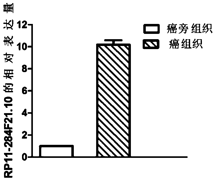 Long noncoding RNA (lncRNA) marker associated with hepatocellular carcinoma, and detection primer and application thereof