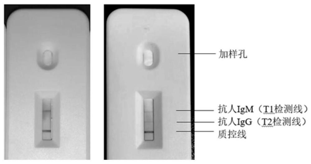 Serum CENPF antibody (IgG and IgM) detection colloidal gold test strip