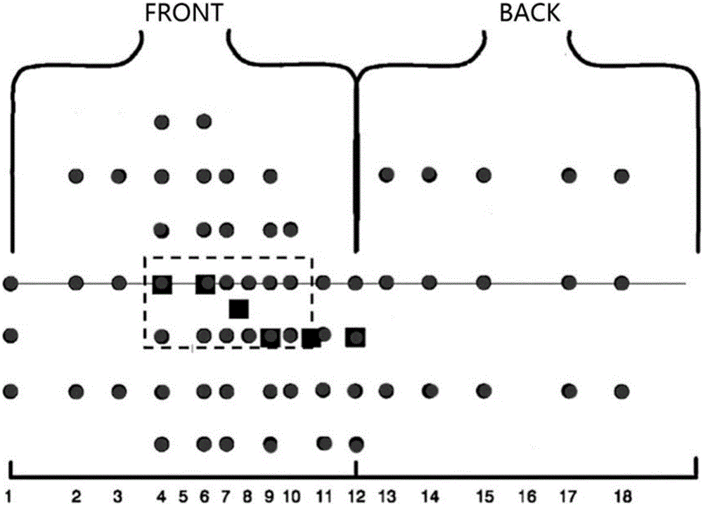 Ventricular premature beat abnormal activation site positioning method based on ECGI (electrocardiographic imaging)