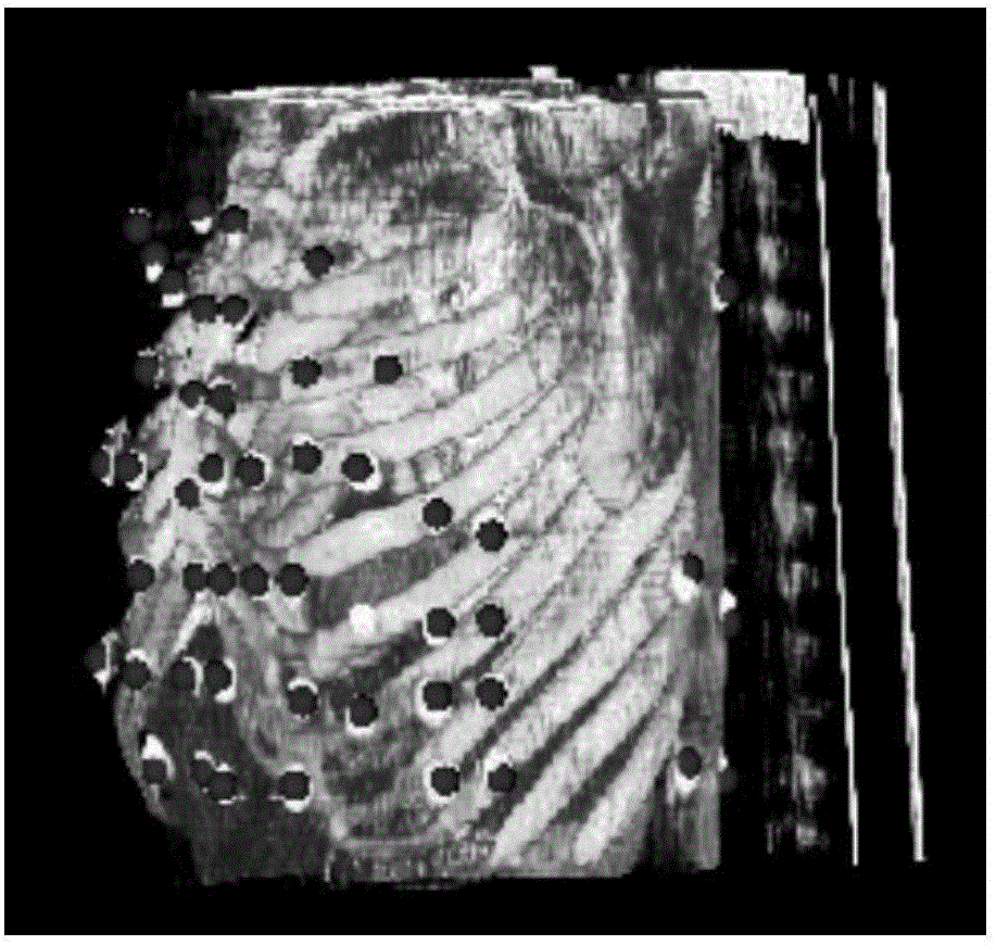 Ventricular premature beat abnormal activation site positioning method based on ECGI (electrocardiographic imaging)