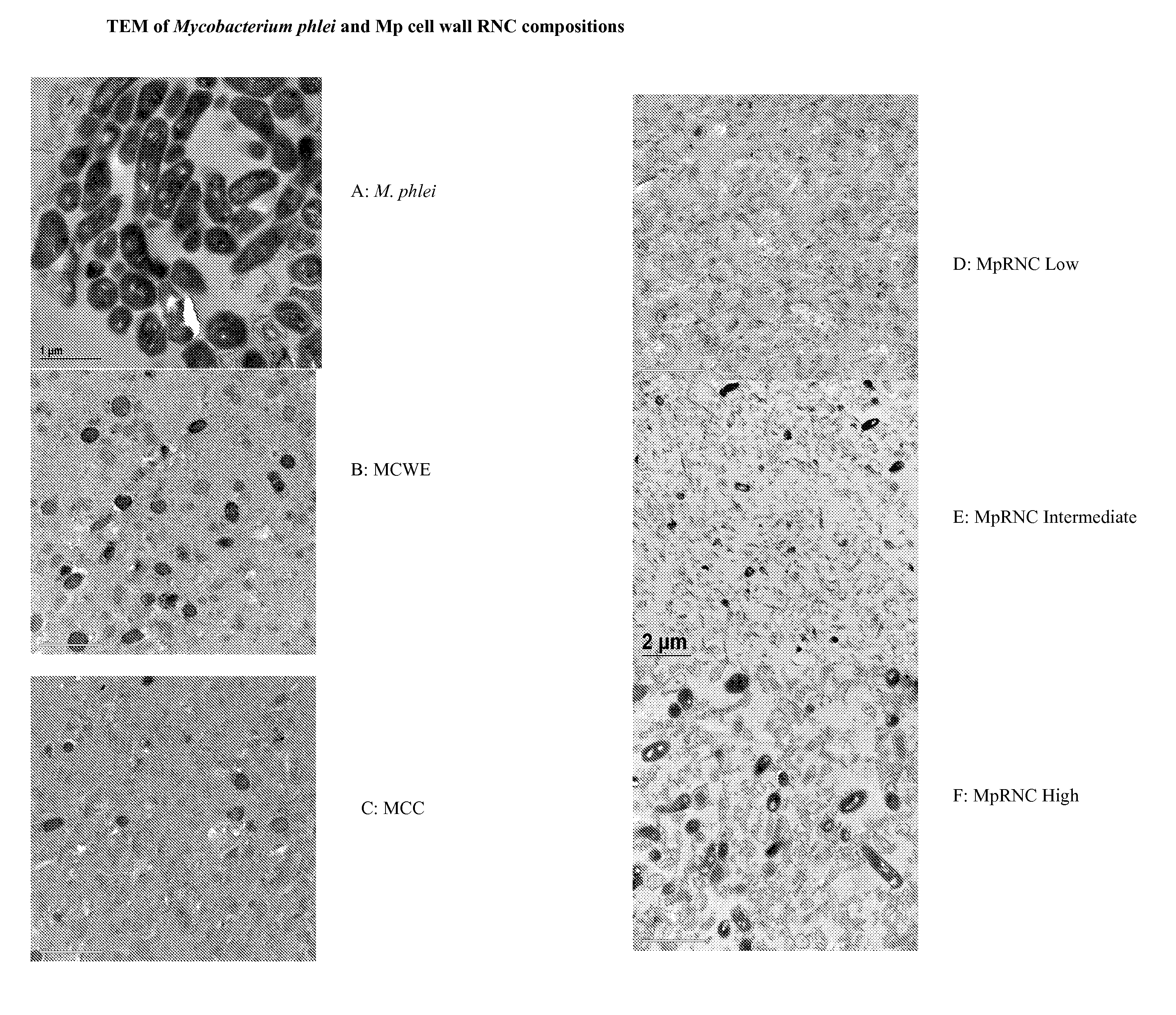 Bacterial ribonucleic acid cell wall compositions and methods of making and using them