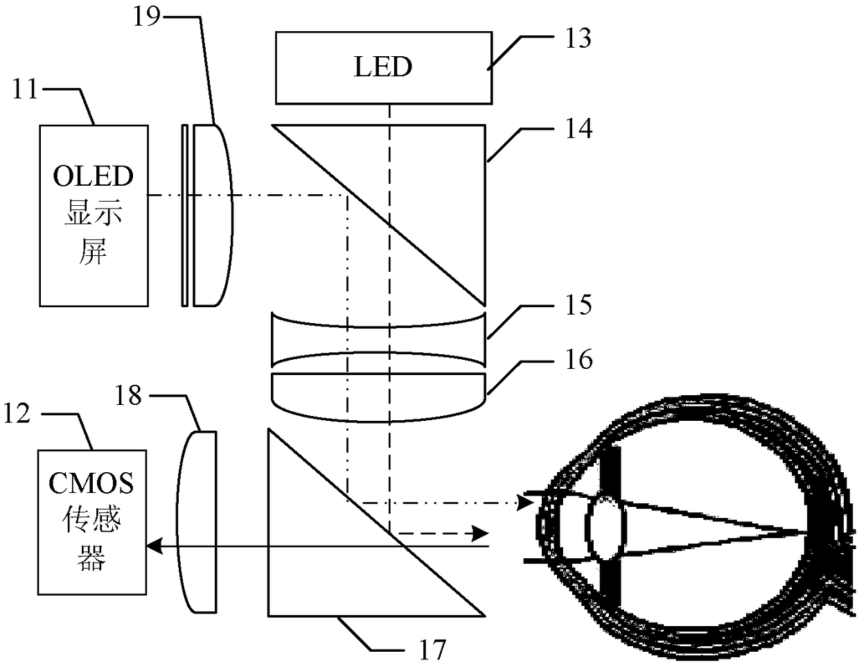 Early screening device for diabetic eye diseases