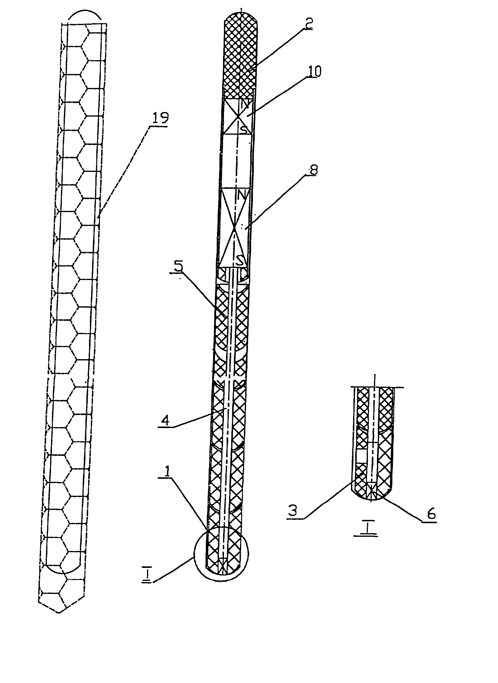 Penile prosthesis and method of implantation