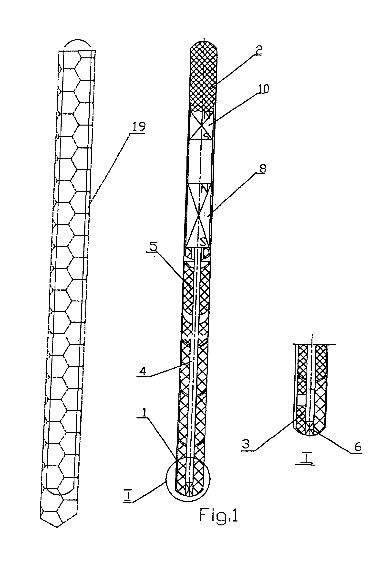 Penile prosthesis and method of implantation