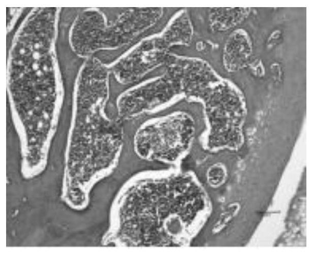 Transdermal drug delivery preparation for treating knee osteoarthritis and preparation method thereof