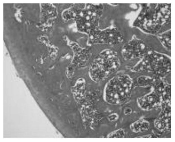 Transdermal drug delivery preparation for treating knee osteoarthritis and preparation method thereof