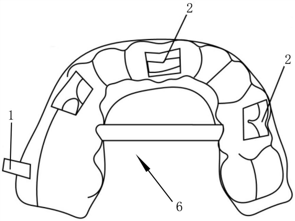 Maxillary sinus lifting side wall fenestration indication guide plate and manufacturing method thereof