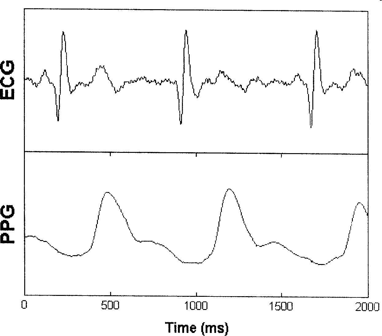 Physiological parameter measuring apparatus