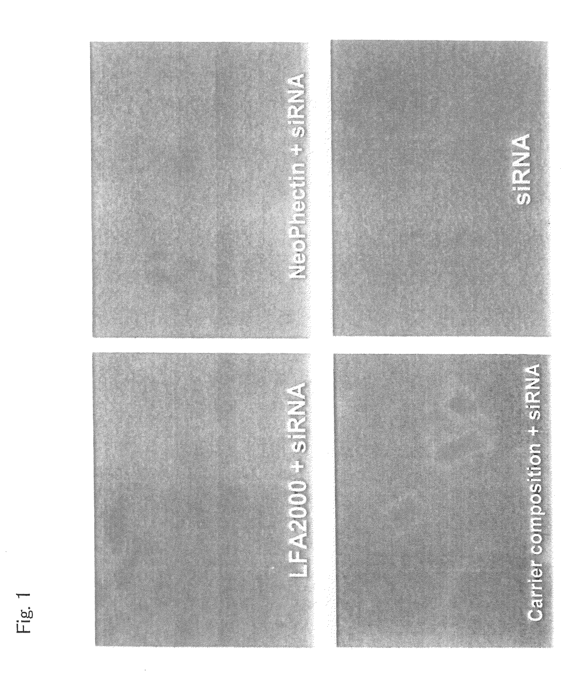 Carrier composition for nucleic acid transport