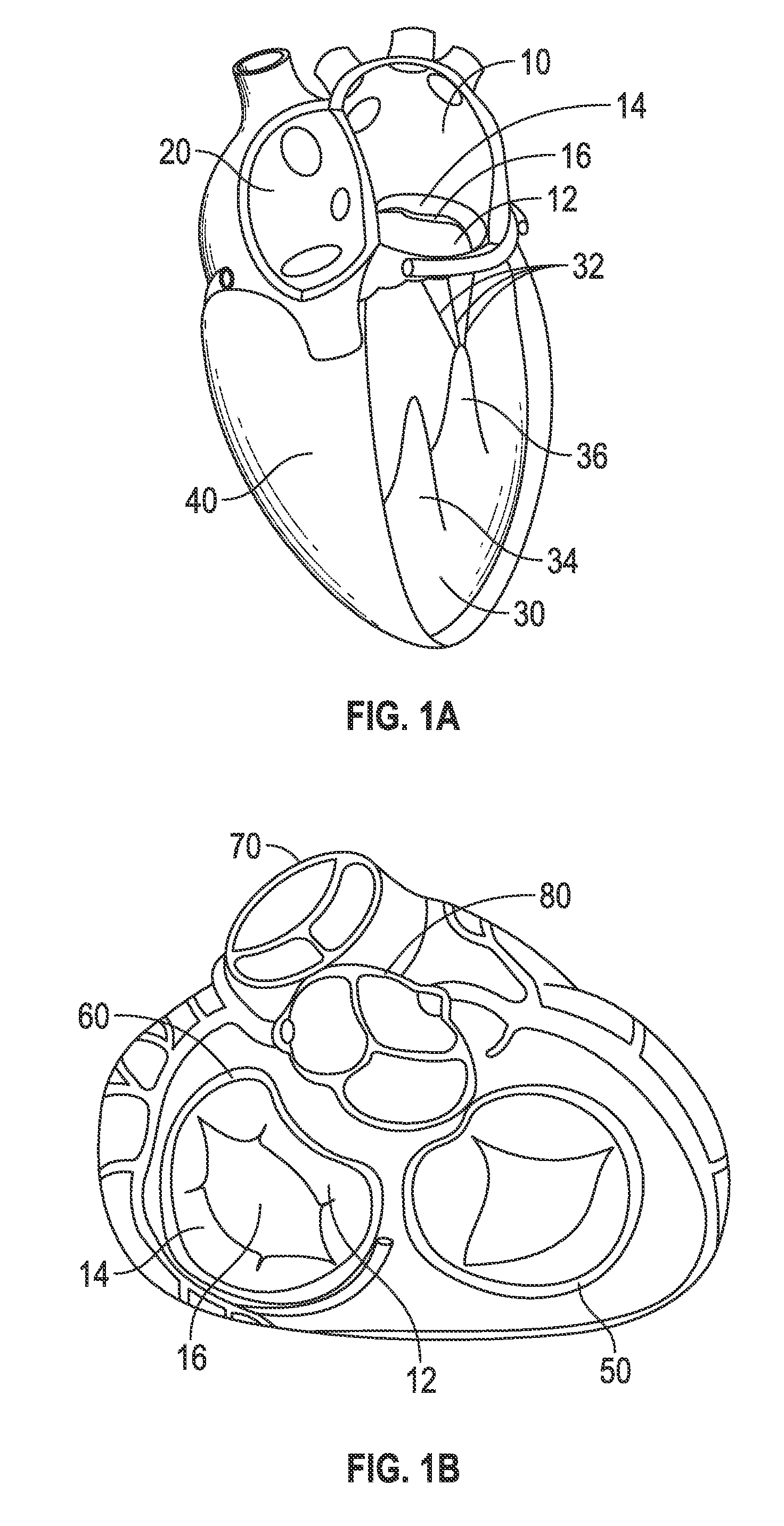 Systems and methods for anchoring an implant