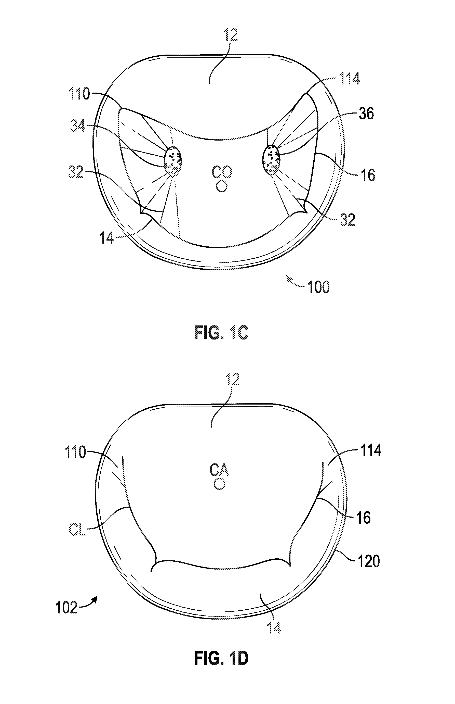 Systems and methods for anchoring an implant