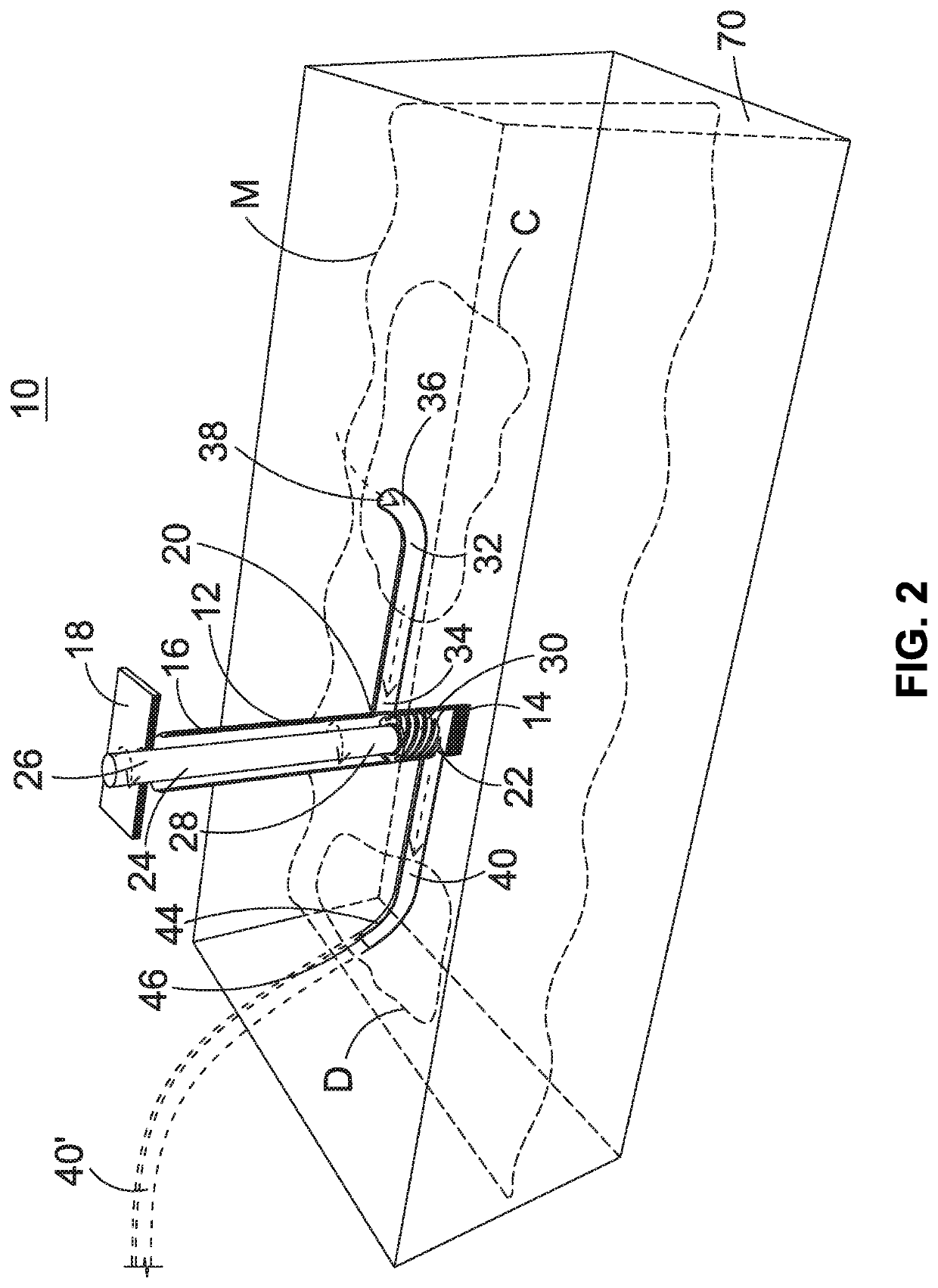 Tube pump for removing dross during galvanizing