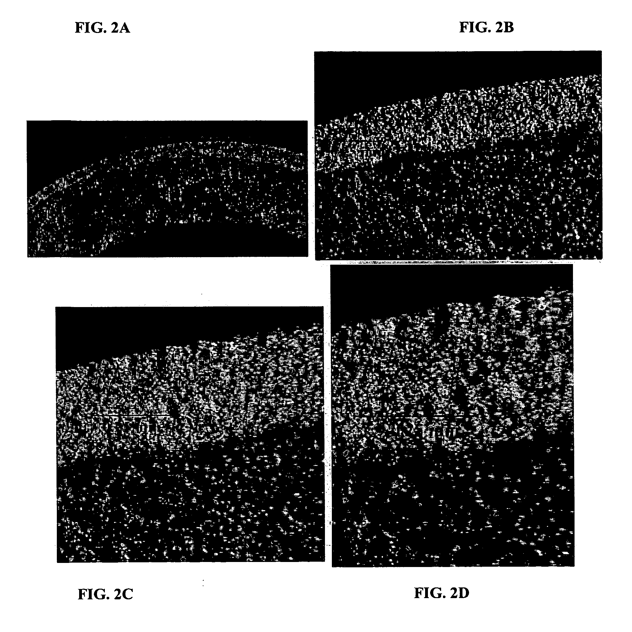 Composite Structures with Porous Anodic Oxide Layers and Methods of Fabrication