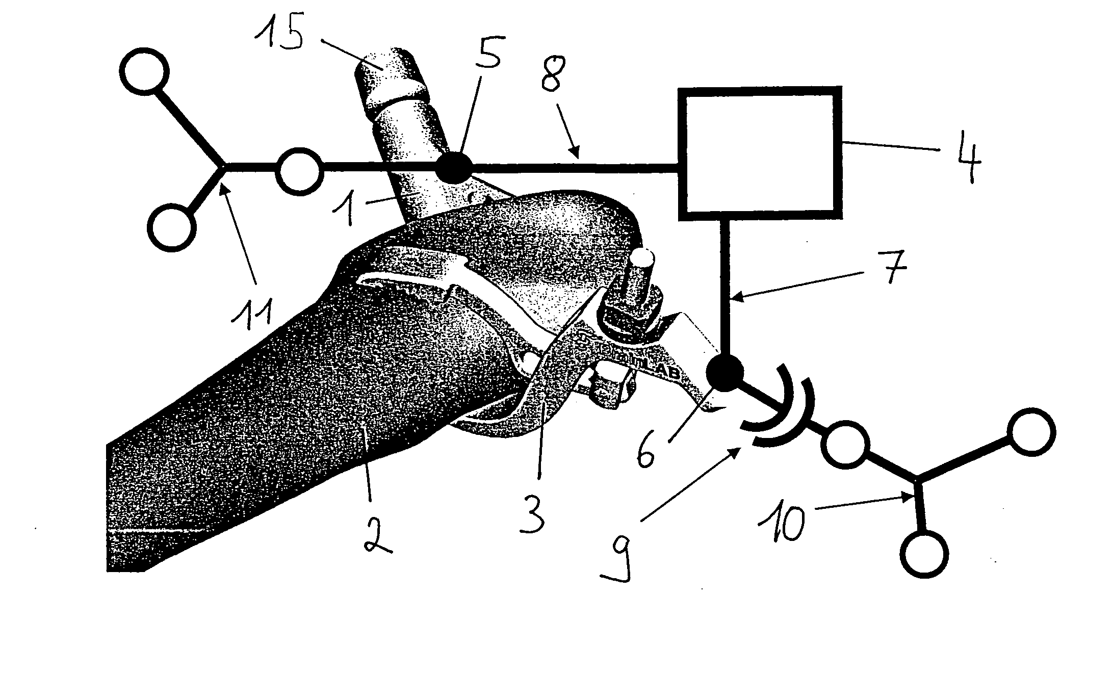 Positioning system with cannulated implant