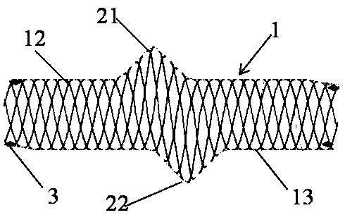 Developing drug-carrying titanium alloy stent