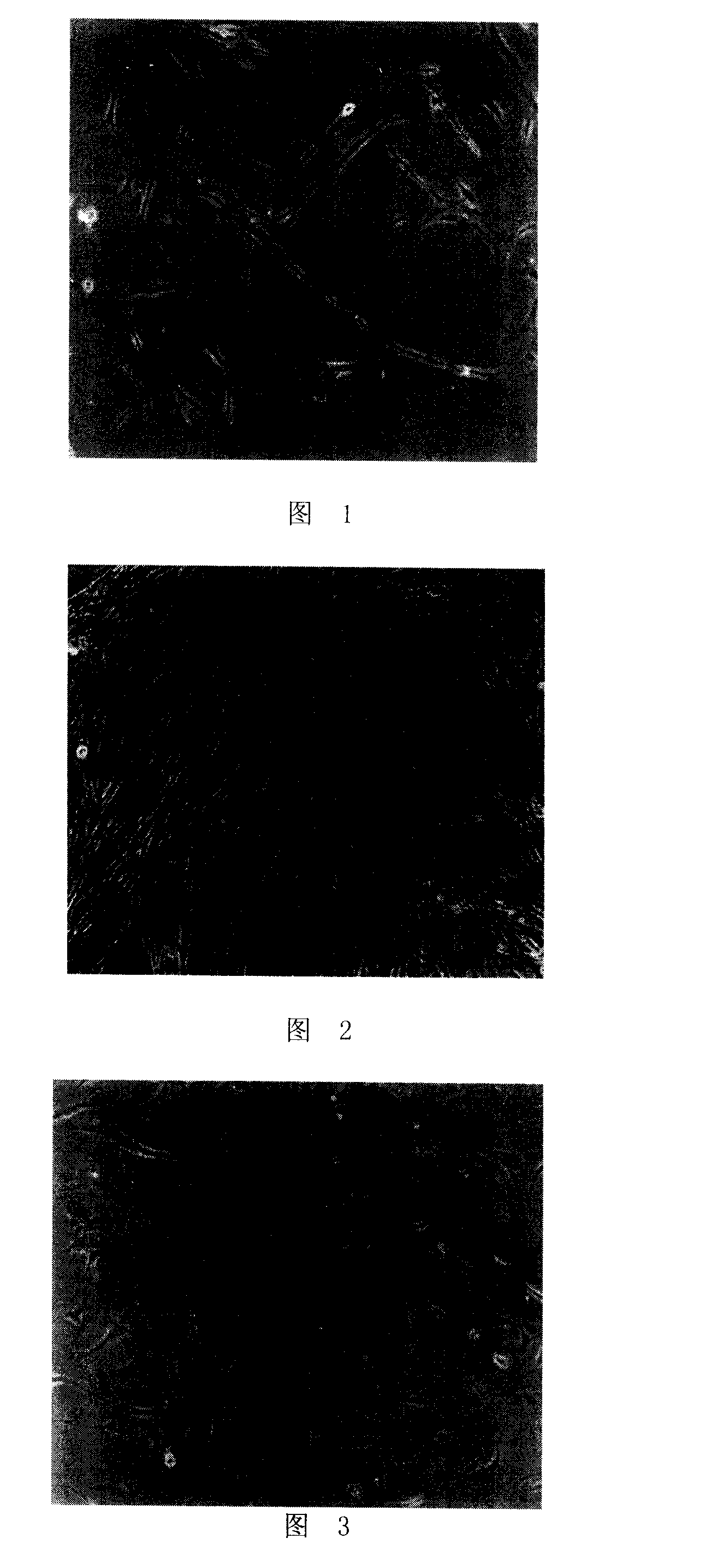 Method for cultivating adult distal arteria pulmonalis smooth muscle cells