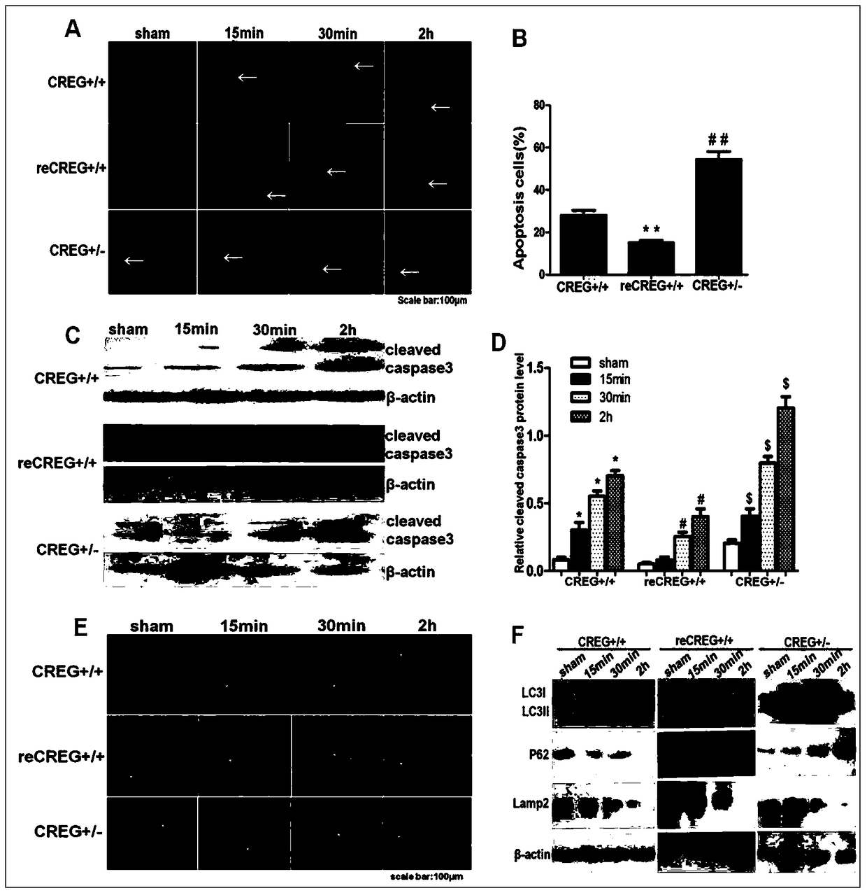 Medical application of creg protein in protecting myocardial ischemia-reperfusion injury