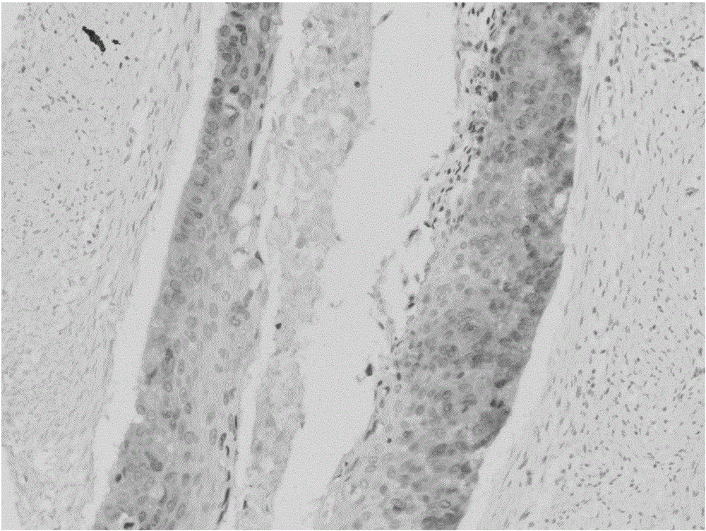 Anti-p16 monoclonal antibody and preparation method and application thereof