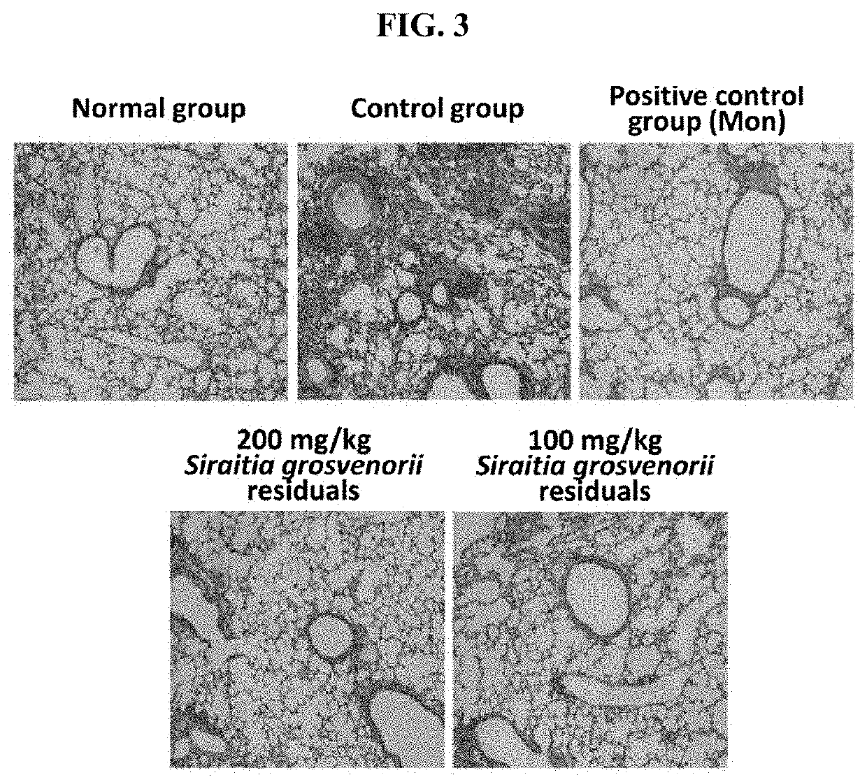 Composition for preventing, ameliorating, or treating respiratory disease comprising siraitia grosvenorii extract as effective component