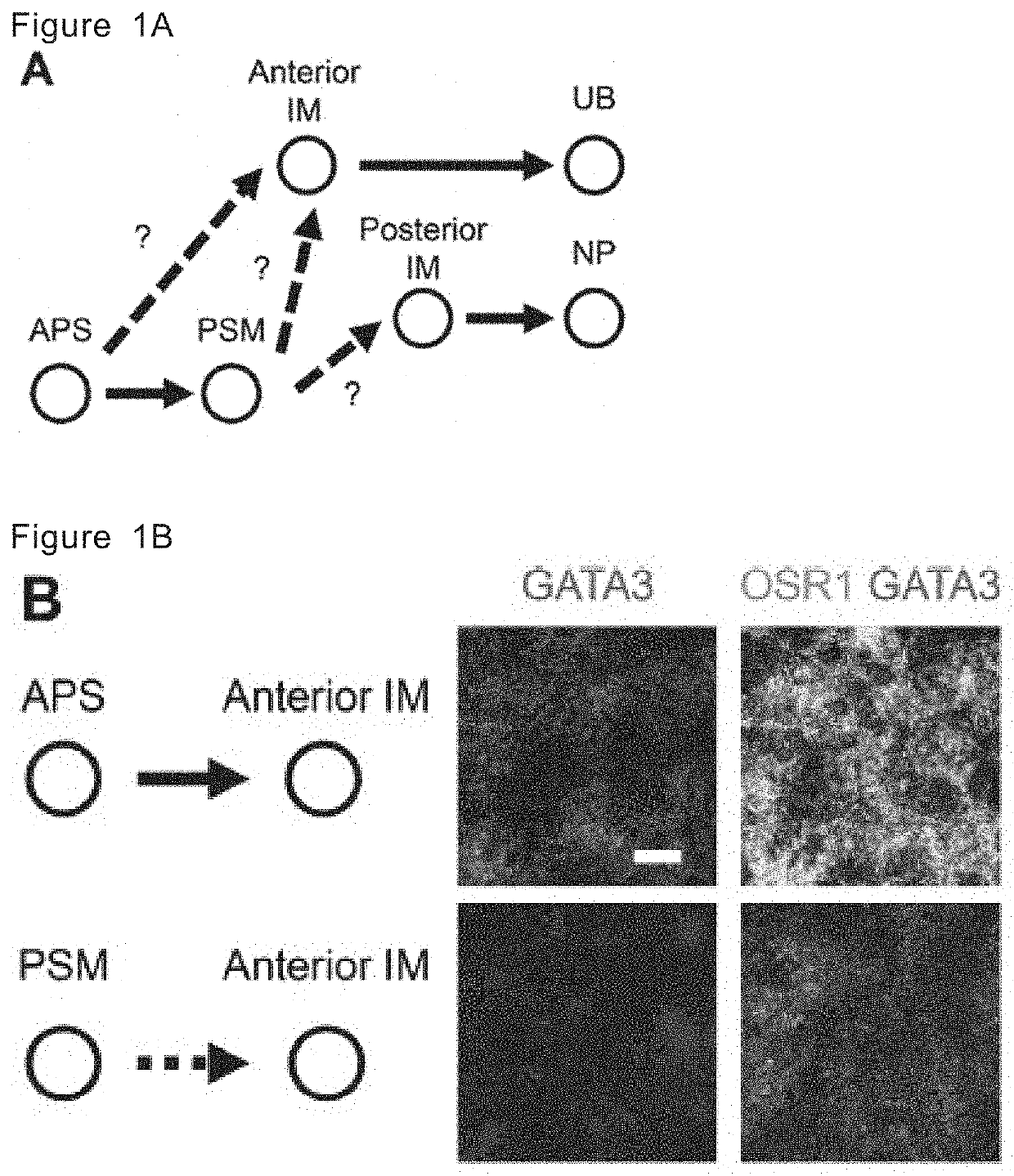 Method for inducing ureteric bud-like tissue