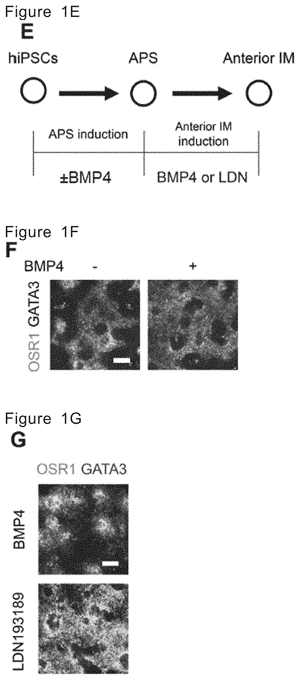 Method for inducing ureteric bud-like tissue