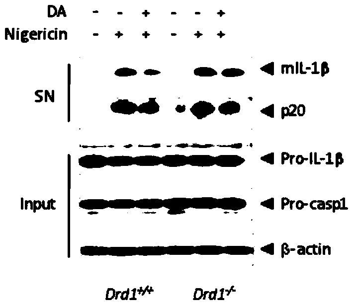 DRD1 protein and application of agonists of DRD1 protein in preparation of medicine for treating related inflammatory diseases of NLRP3 inflammasome