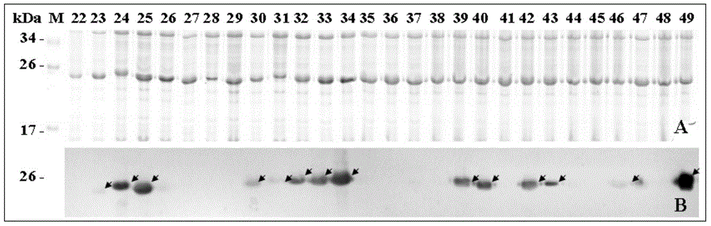 Epitope peptide in human egg zona pellucida protein 4 and its application