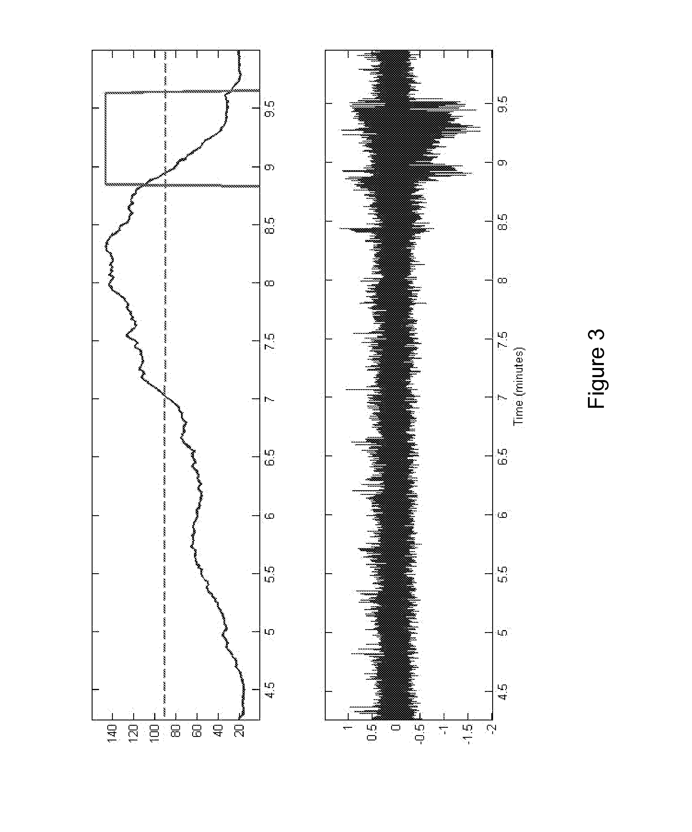 System and method of detecting and predicting seizures