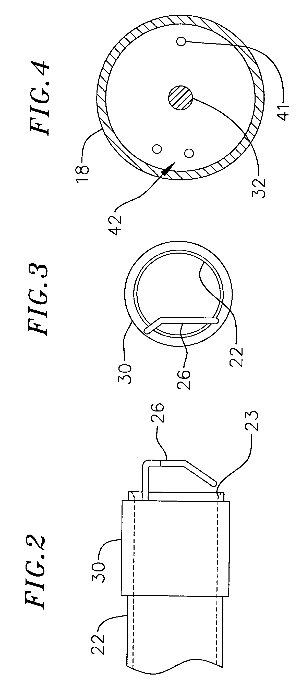 Loop structures for positioning a diagnostic or therapeutic element on the epicardium or other organ surface