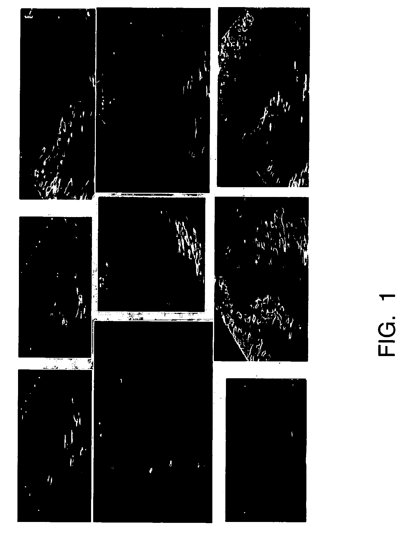 Method for database guided simultaneous multi slice object detection in three dimensional volumetric data