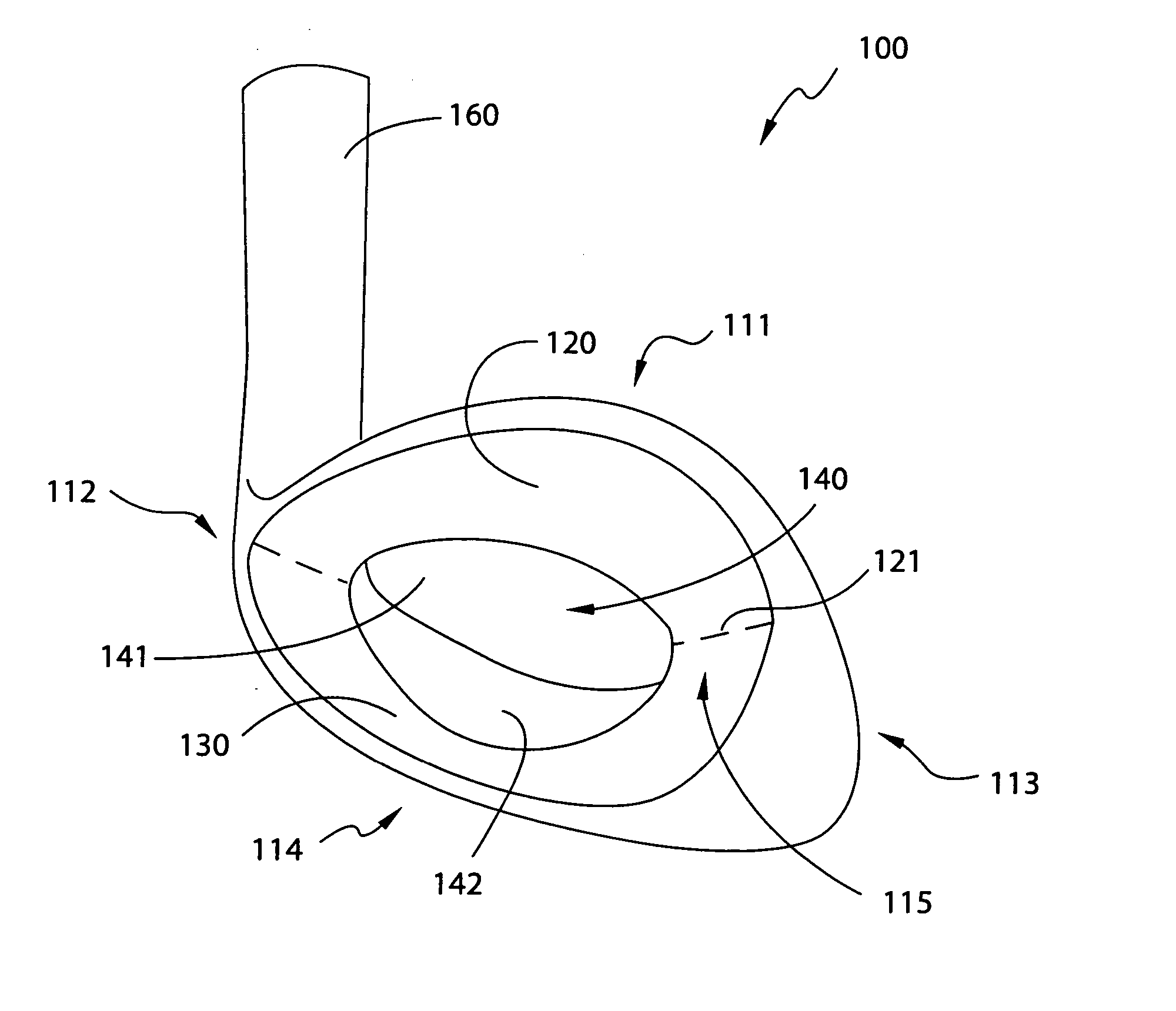 Muscle-back, with insert, iron type golf club head