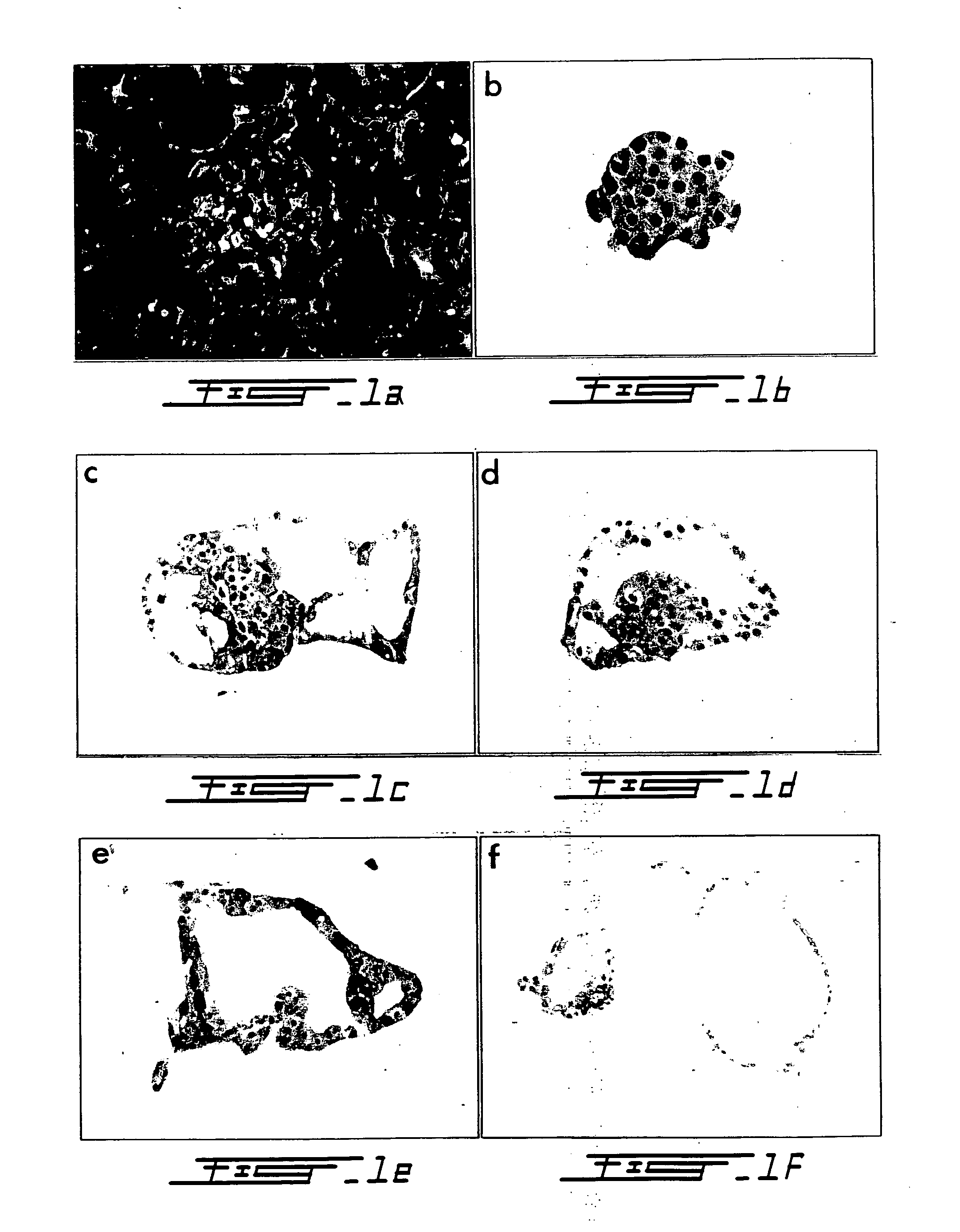 Medium for preparing dedifferentiated cells