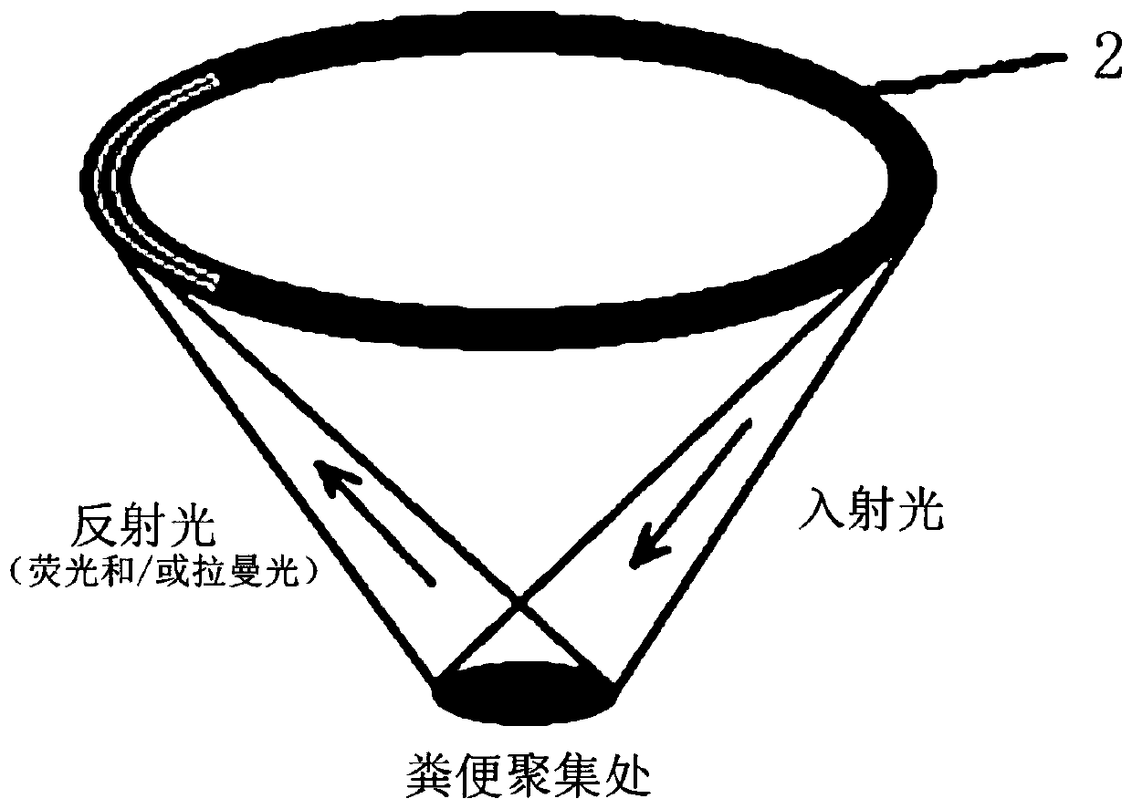 Disease early warning system based on excrement ecological evaluation, health monitoring ring and closestool